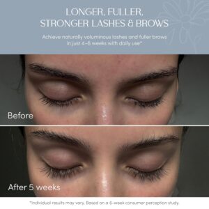 Eyelash & Brow Growth Serum – Biotin & Peptides, 6ml, 6-Month Supply - Image 3